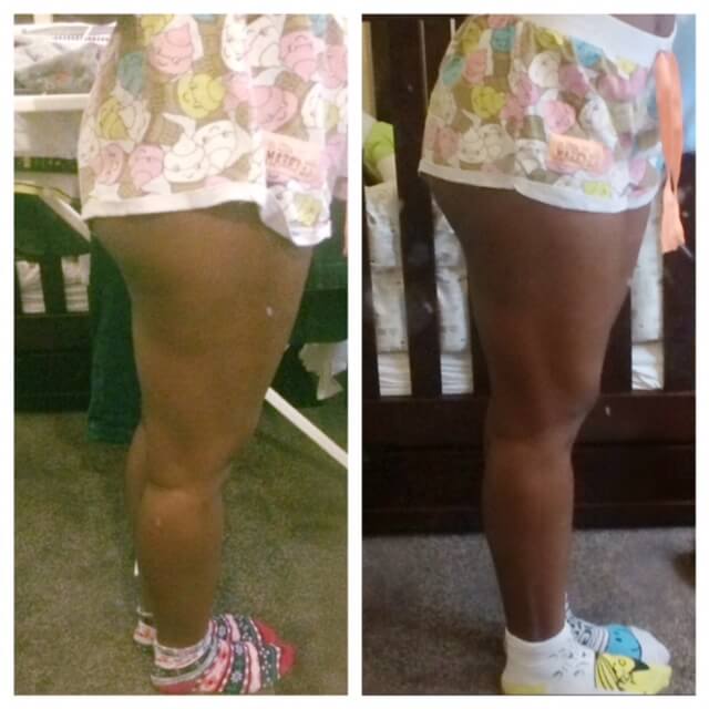 30 day leg challenge before and after